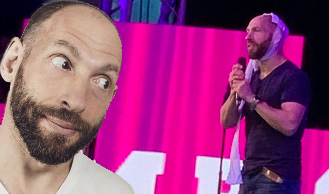 Bet that Bloomin' hurt | See the moment comic Adam Bloom split his head open on stage