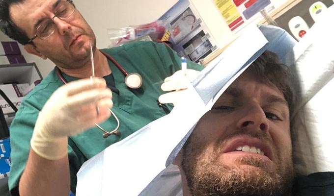 Joel Dommett injured on I'm A Celebrity... | Comic needs stitches after a being hit on the head